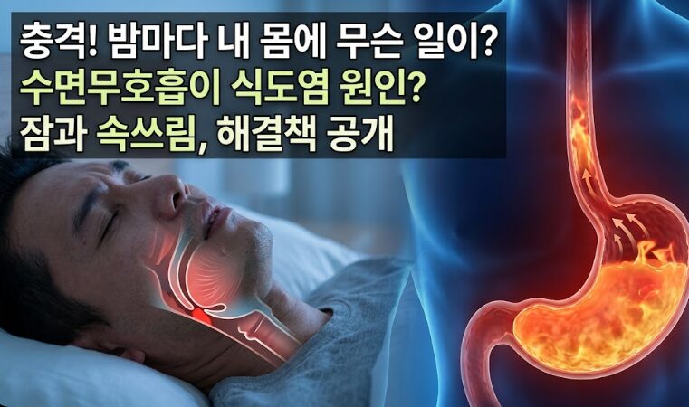 수면무호흡과 역류성식도염 관계 – 밤마다 속이 쓰린 이유가 수면무호흡?