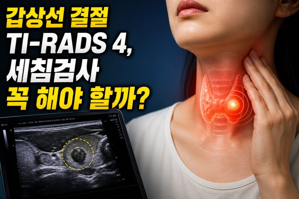 갑상선 결절 TI-RADS 4, 세침검사 꼭 해야 할까?