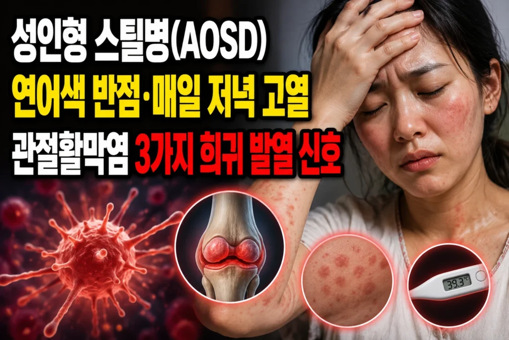성인형 스틸병(AOSD) — 연어색 반점·매일 저녁 고열·관절활막염 3가지 희귀 발열 신호