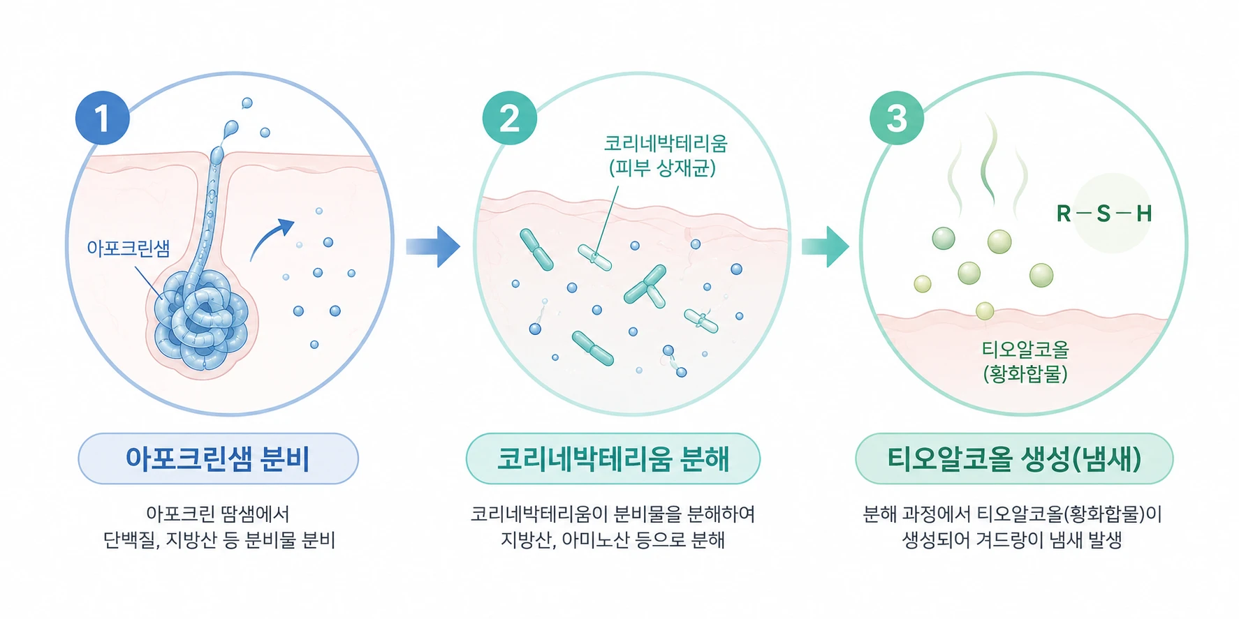 아포크린샘 분비 → 코리네박테리움 분해 → 티오알코올 생성으로 이어지는 겨드랑이 냄새 3단계 메커니즘 인포그래픽