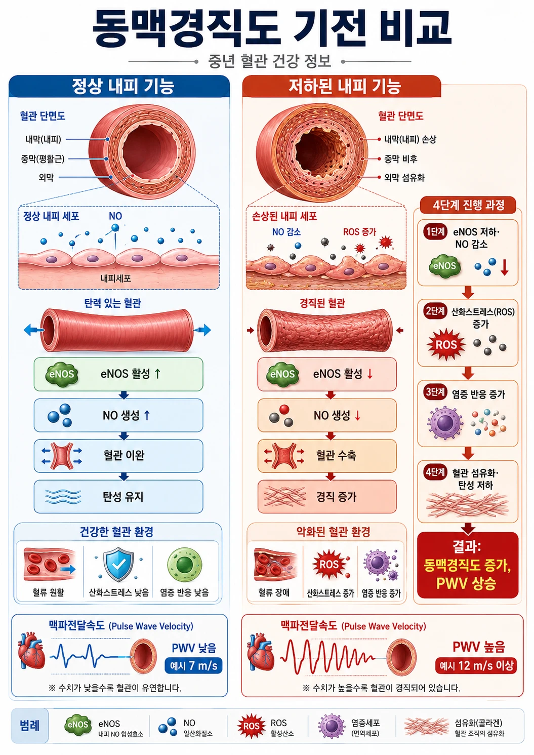 정상 내피 기능(eNOS 활성·NO 생성↑)과 저하된 내피 기능(ROS 증가·NO 감소·PWV 상승) 차이를 좌우 비교한 동맥경직도 기전 인포그래픽