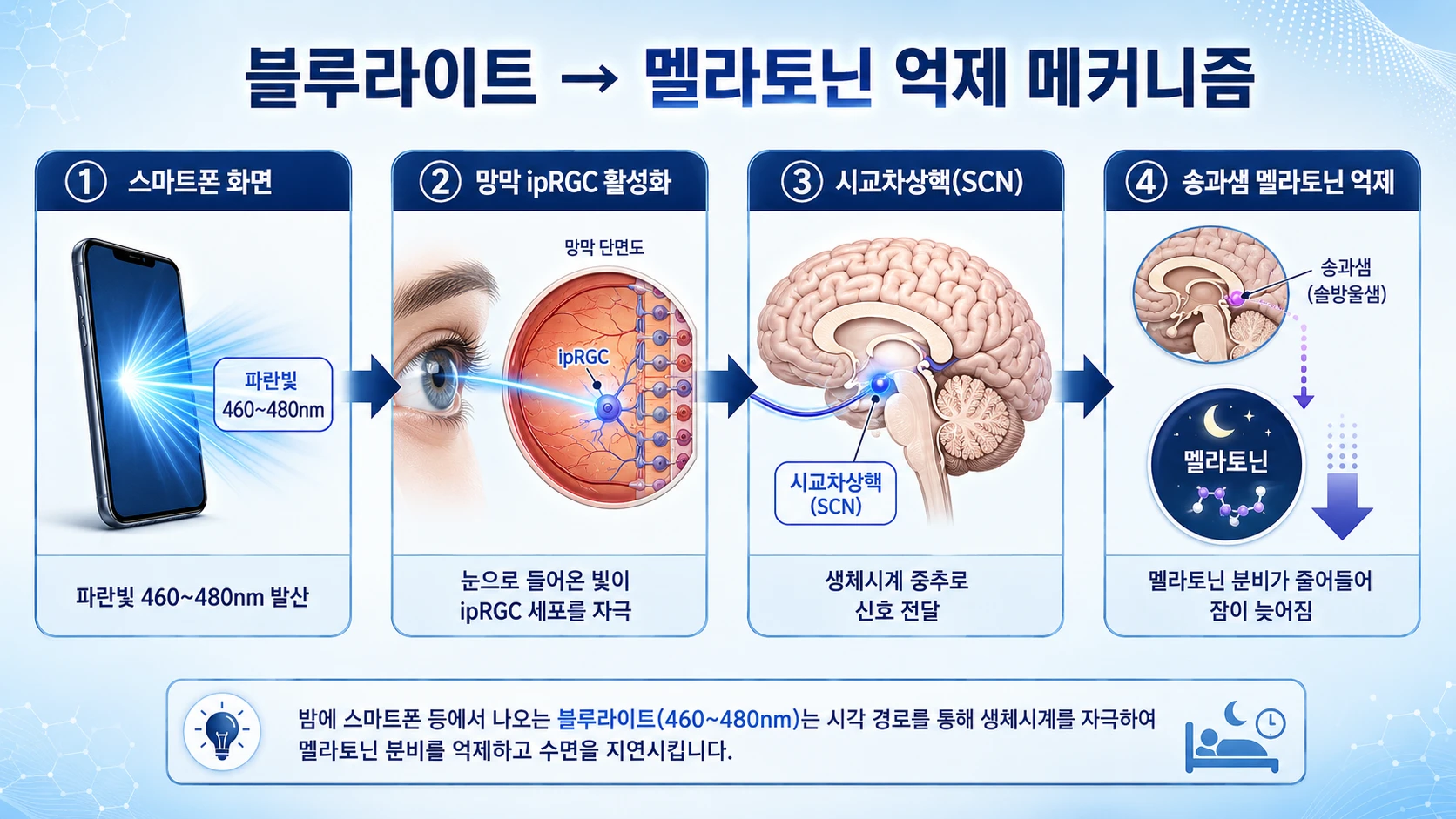블루라이트 → 멜라토닌 억제 메커니즘 — 스마트폰·망막 ipRGC·시교차상핵·솔과샘 4단계
