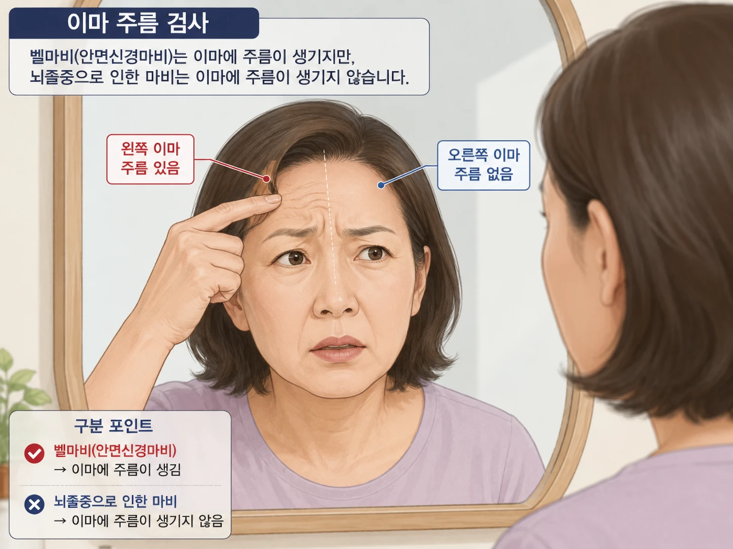 중년 여성이 거울 앞에서 이마를 찡그려 주름을 확인하는 장면. 왼쪽 이마에 주름이 생기고 오른쪽 이마에는 주름이 없어 벨마비(안면신경마비)임을 나타낸다.
