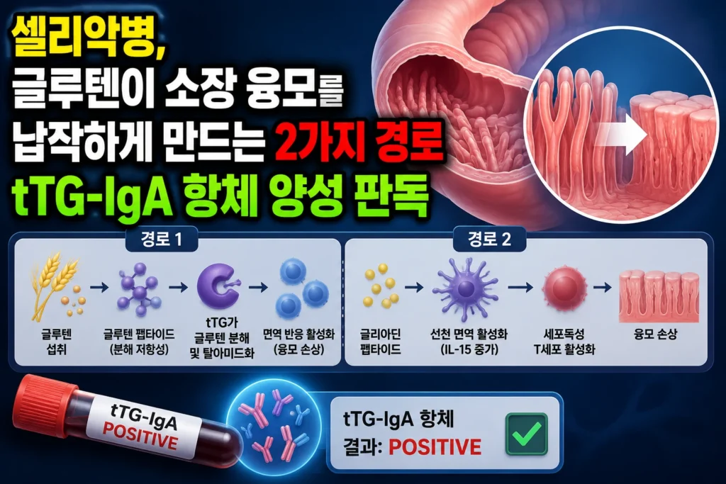 셀리악병 — 글루텐이 소장 융모를 납작하게 만드는 2가지 경로와 tTG-IgA 항체 양성 판독