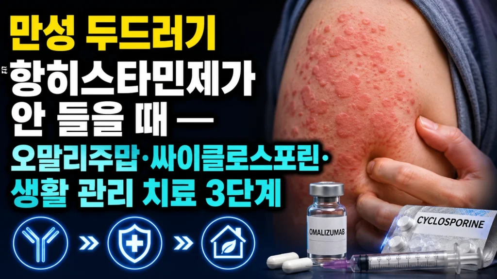 만성 두드러기 항히스타민제가 안 들을 때 — 오말리주맙·싸이클로스포린·생활 관리 치료 3단계