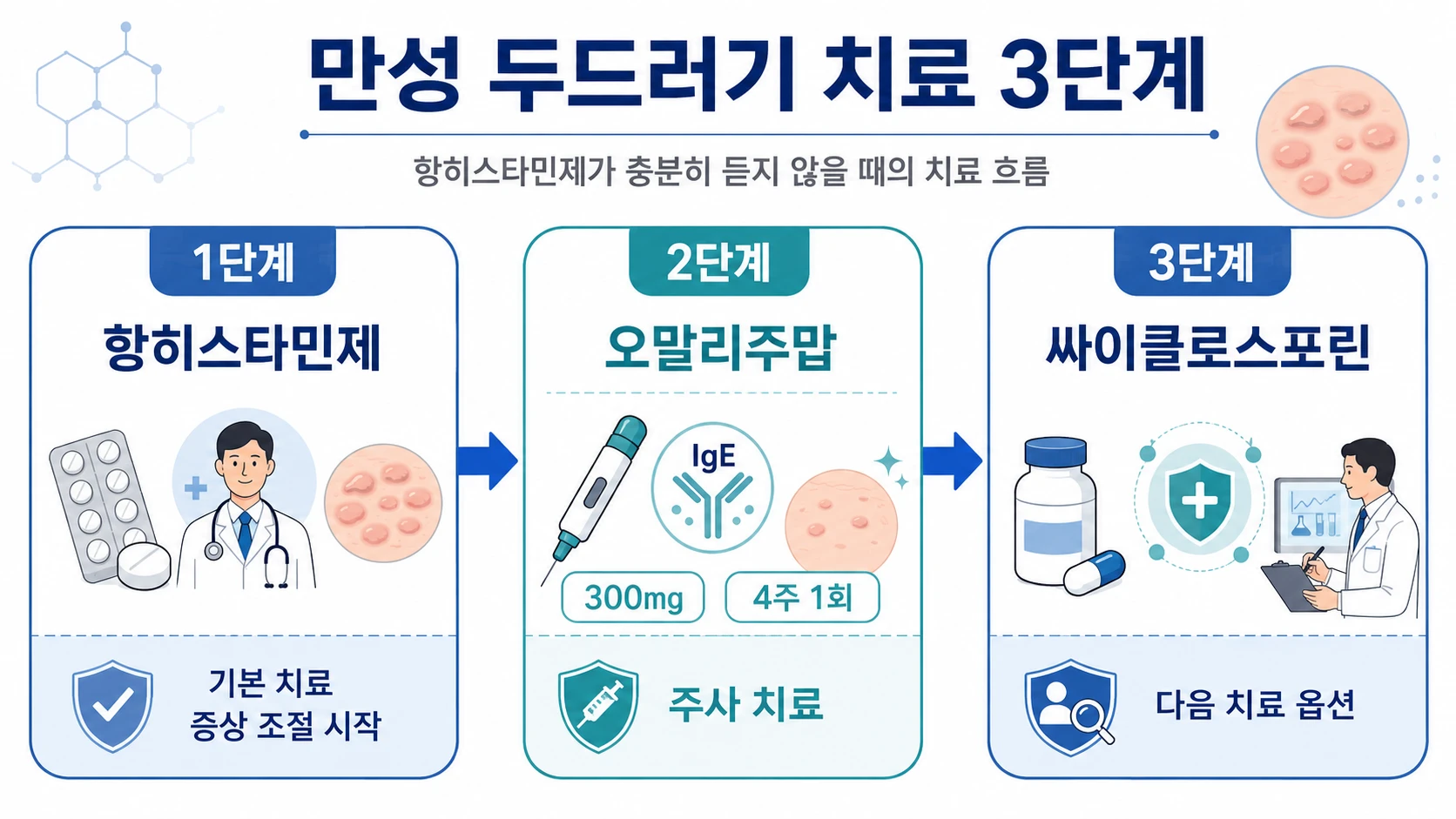 만성 두드러기 치료 단계별 흐름을 보여주는 인포그래픽 — 1단계 항히스타민제, 2단계 오말리주맙, 3단계 싸이클로스포린