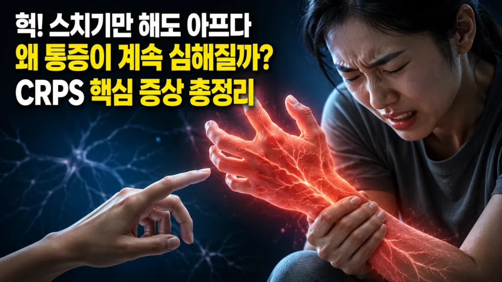 CRPS(복합부위통증증후군) — 작열통·트로픽 변색·비대칭 발한 3징후와 부다페스트 진단 기준 4항목