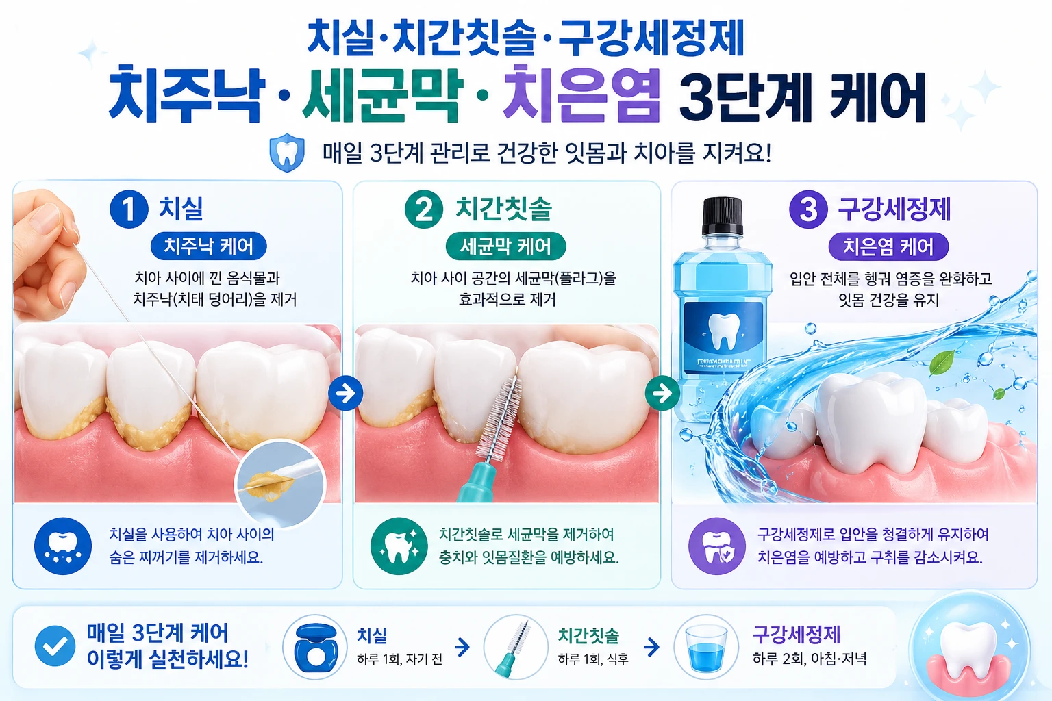 치실·치간칫솔·구강세정제를 순서대로 사용하는 치주낭 세균막 제거와 치은염 예방 3단계 케어 인포그래픽