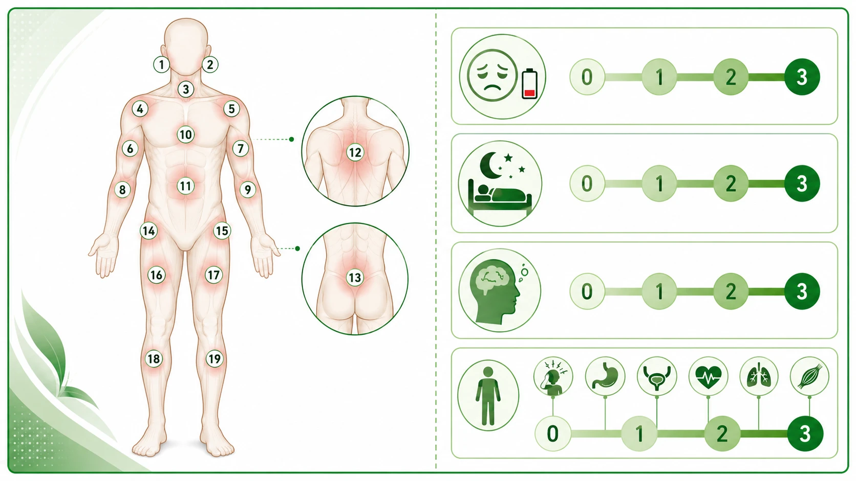 섬유근통 진단에 사용되는 WPI 19개 신체 부위와 SSS 피로·수면·인지 점수 체계를 나란히 정리한 인포그래픽