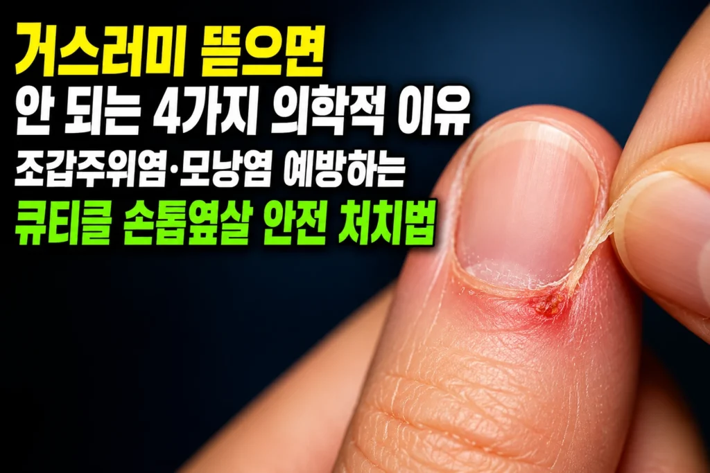 거스러미 뜯으면 안 되는 4가지 의학적 이유 — 조갑주위염·모낭염 예방하는 큐티클 손톱옆살 안전 처치법