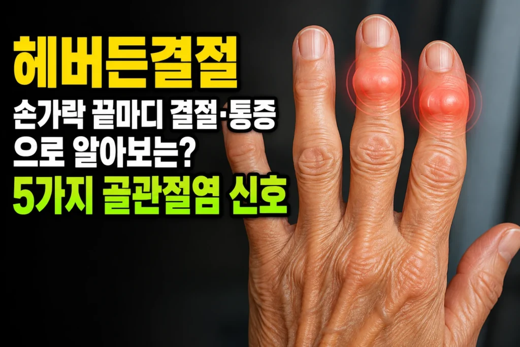 헤버든결절 — 손가락 끝마디 결절·통증으로 알아보는 5가지 골관절염 신호