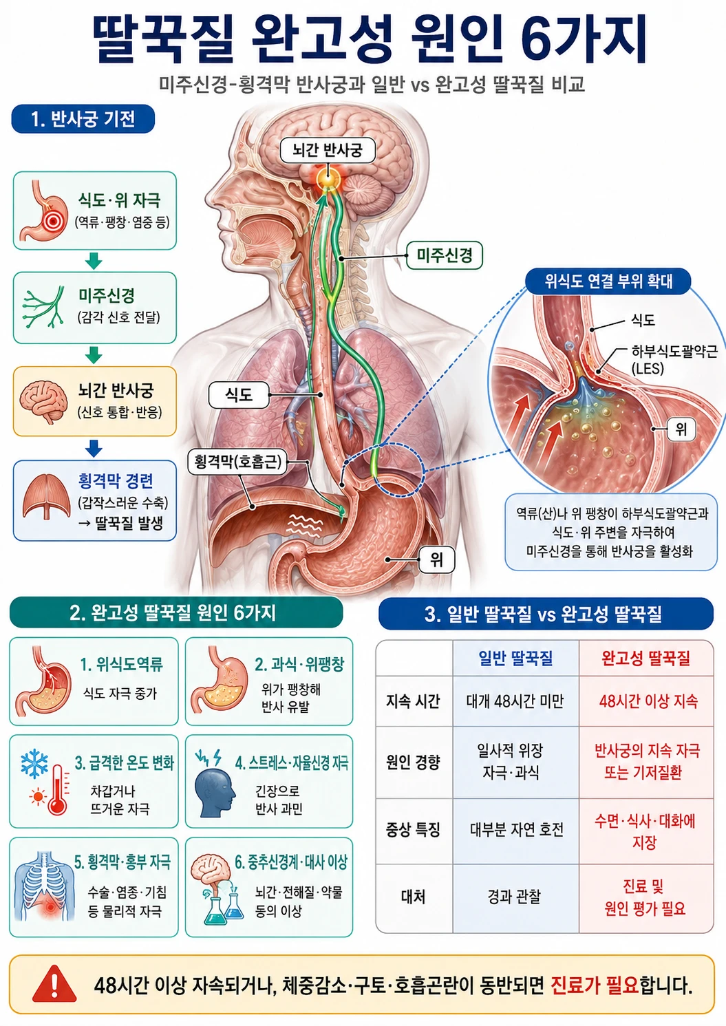 완고성 딸꾹질을 유발하는 미주신경과 횡격막 반사궁 경로를 단면도로 보여주는 의학 교육용 해부 일러스트