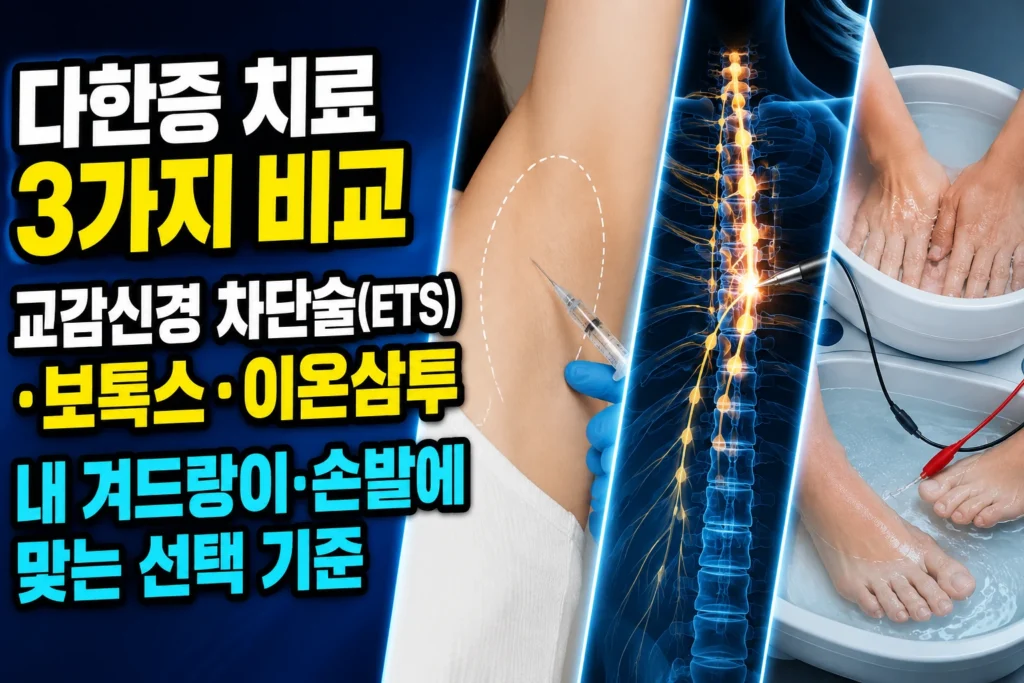 다한증 치료 3가지 비교 — 교감신경 차단술(ETS)·보톡스·이온삼투 중 내 겨드랑이·손발에 맞는 선택 기준