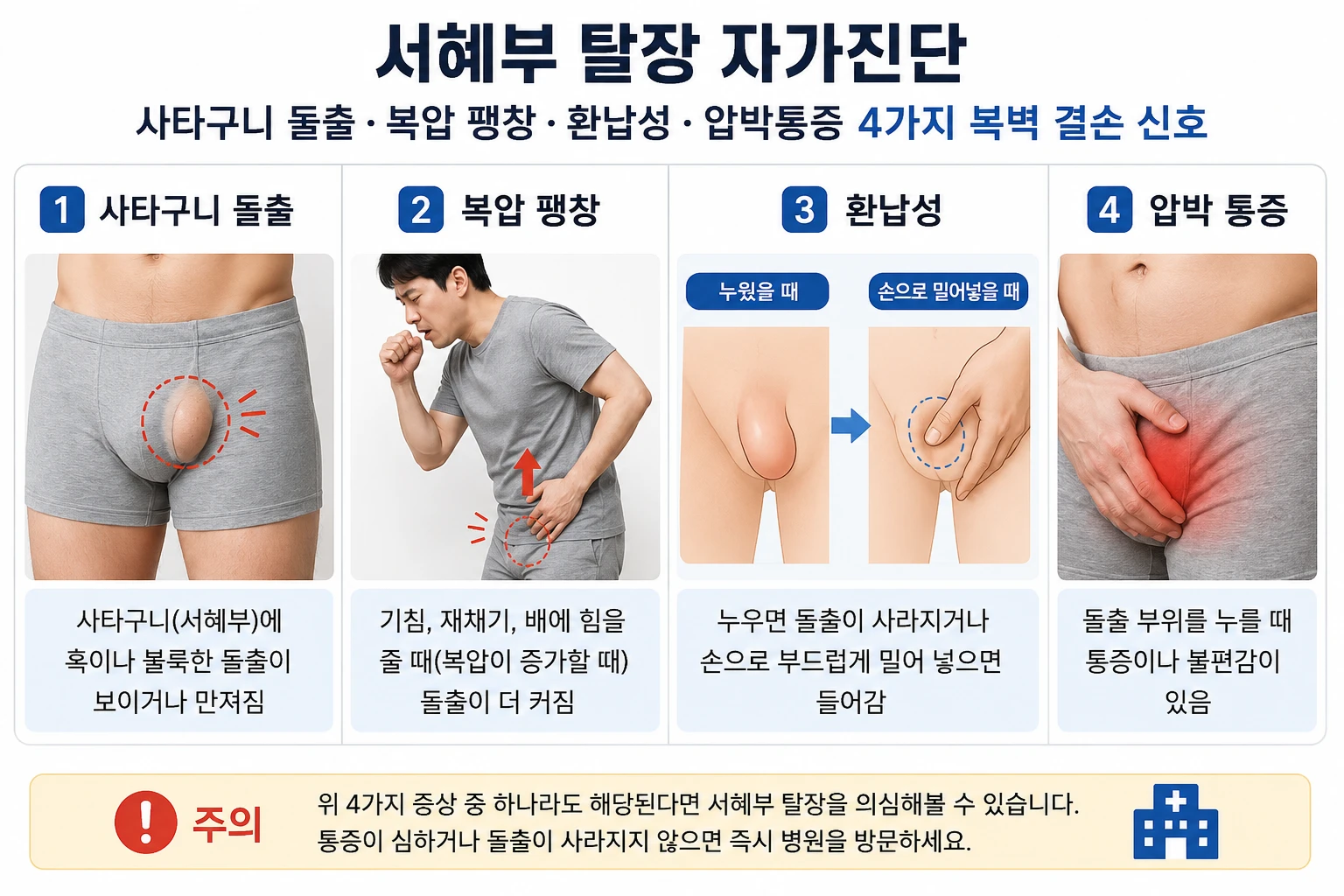 서혜부 탈장의 4가지 자가진단 신호(사타구니 돌출·복압 팽창·환납성·압박통증)를 단계별로 설명한 의학 인포그래픽