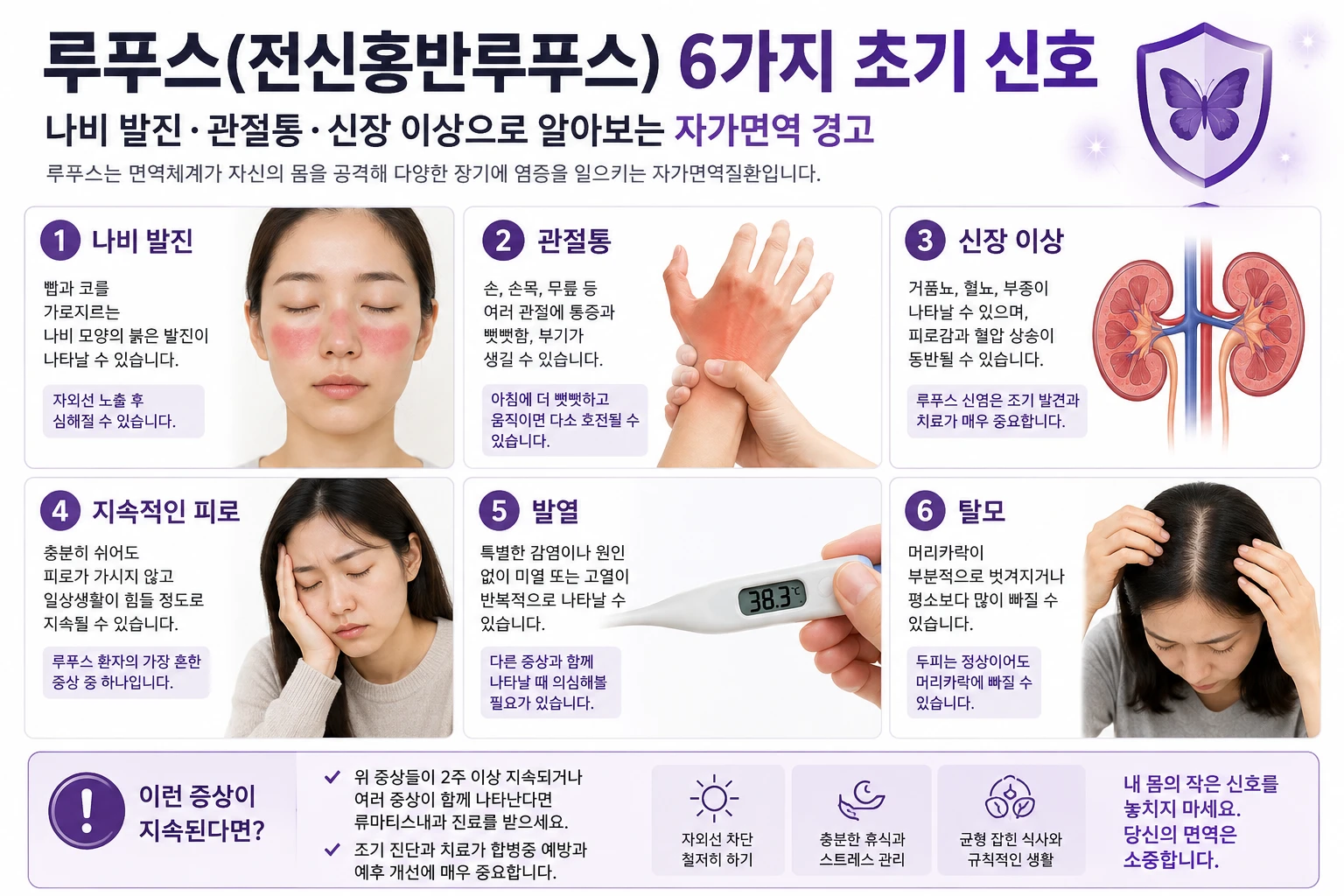 루푸스(전신홍반루푸스) 나비 발진·관절통·신장 이상·피로·발열·탈모 6가지 초기 증상을 그림과 설명으로 정리한 인포그래픽