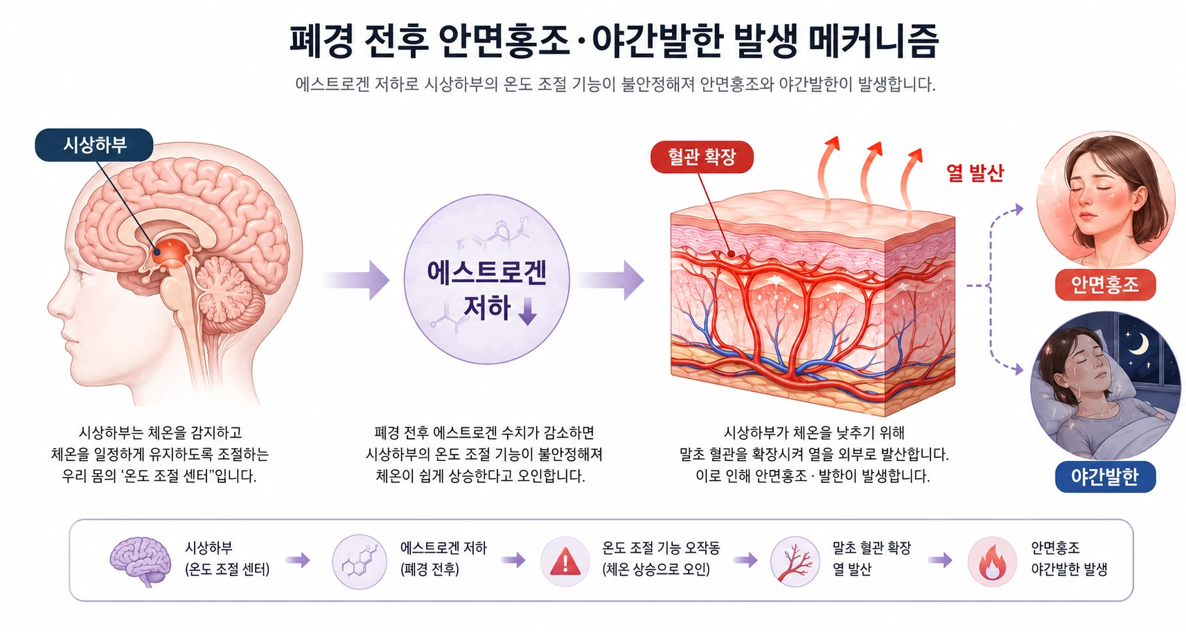시상하부 에스트로겐 저하로 안면홍조와 야간발한이 발생하는 메커니즘을 보여주는 의학 인포그래픽. 시상하부·혈관 확장·열 발산 과정을 단계별로 표시.