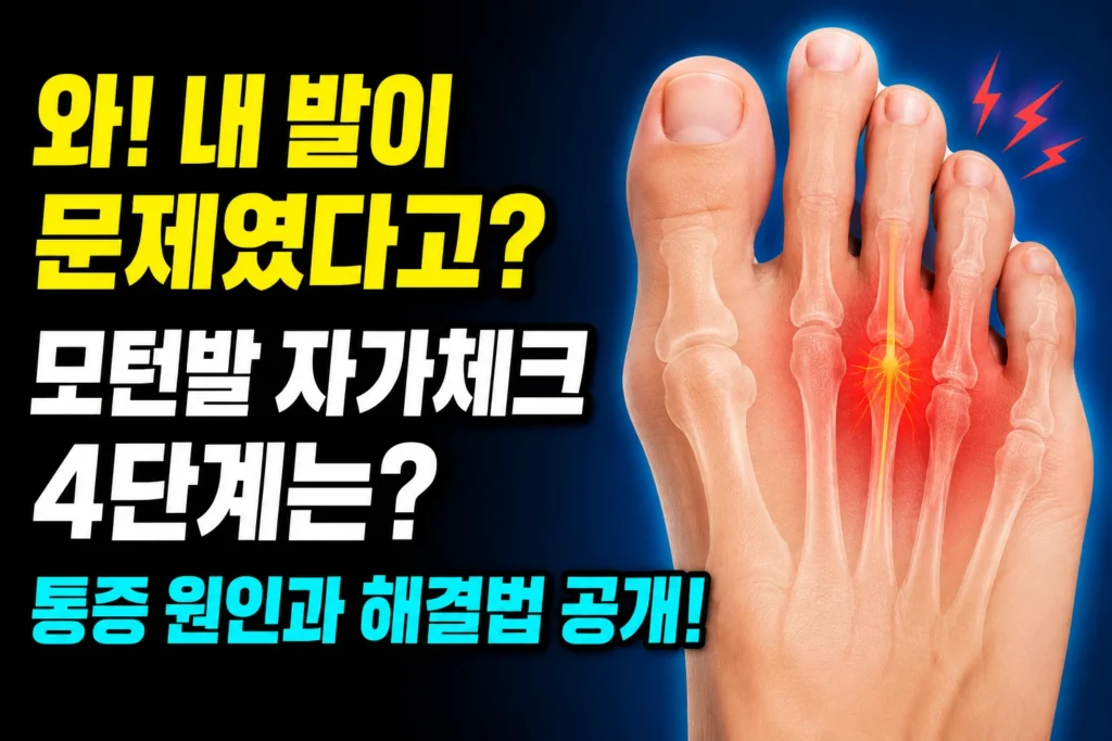 엄지보다 두 번째 발가락이 긴 모턴발 자가체크 4단계 — 모턴신경종·중족골통이 잘 생기는 이유