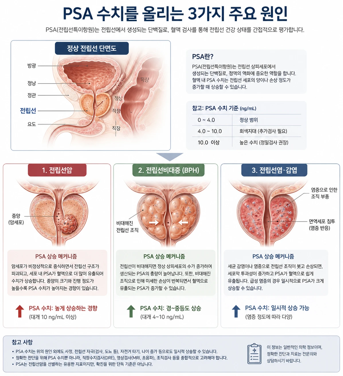 전립선암·전립선비대증·전립선염이 PSA 수치를 올리는 3가지 주요 원인을 비교한 의학 인포그래픽