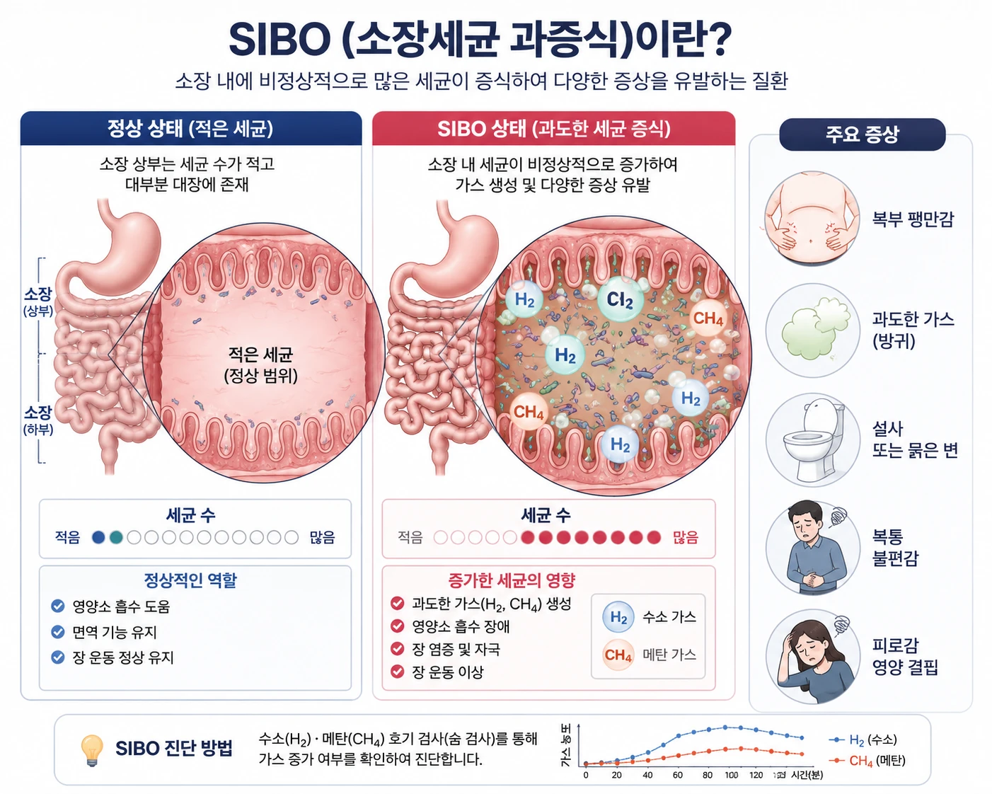 SIBO 소장세균 과증식 — 정상 상태와 SIBO 상태의 소장 세균 비교 인포그래픽