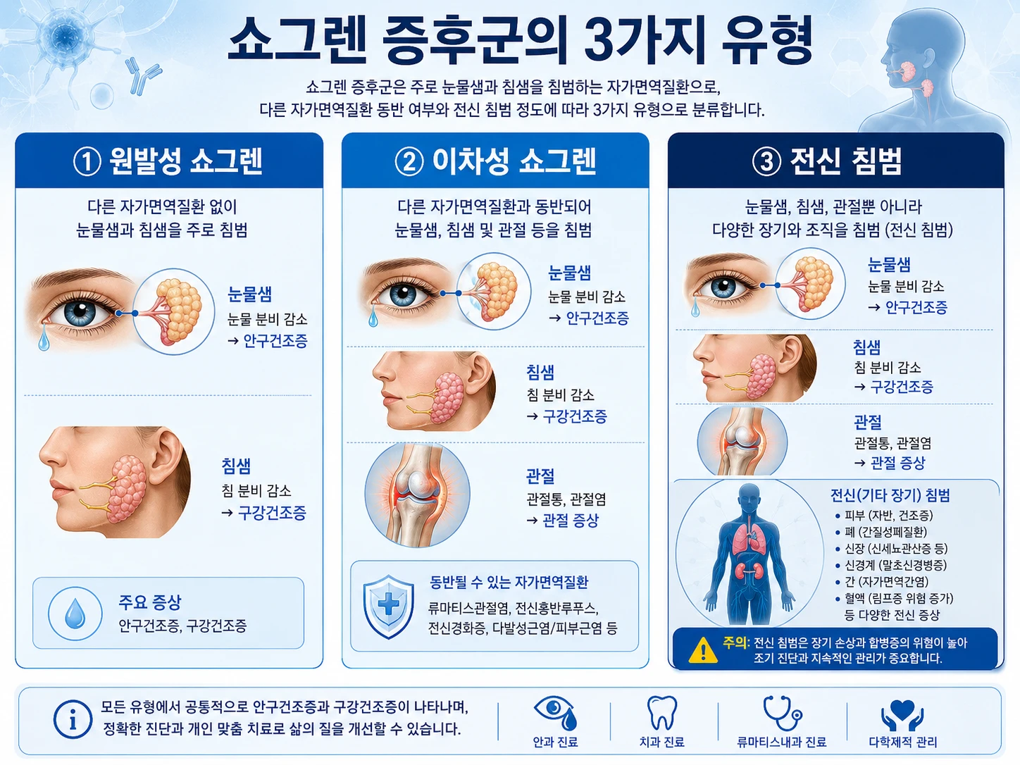쇼그렌증후군의 3가지 유형을 원발성·이차성·전신 침범으로 구분한 인포그래픽