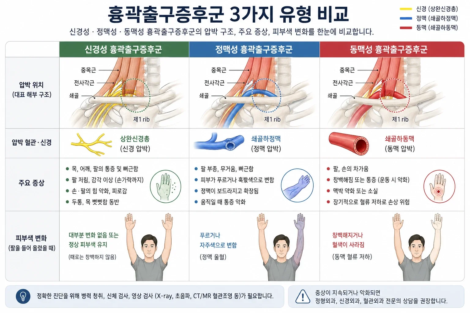 흉곽출구증후군 신경성·정맥성·동맥성 3가지 유형의 압박 구조, 주요 증상, 피부색 변화를 비교한 의학 인포그래픽
