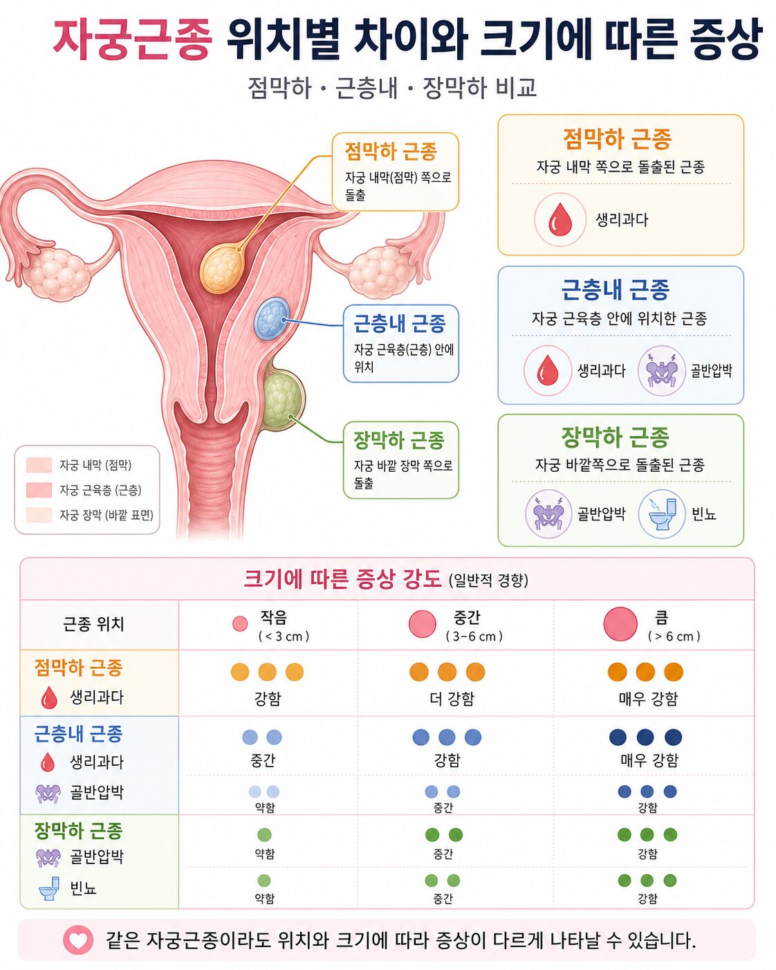 자궁근종 점막하·근층내·장막하 위치별 특징과 크기에 따른 증상 강도(생리과다·골반압박·빈뇨)를 비교한 의학 인포그래픽