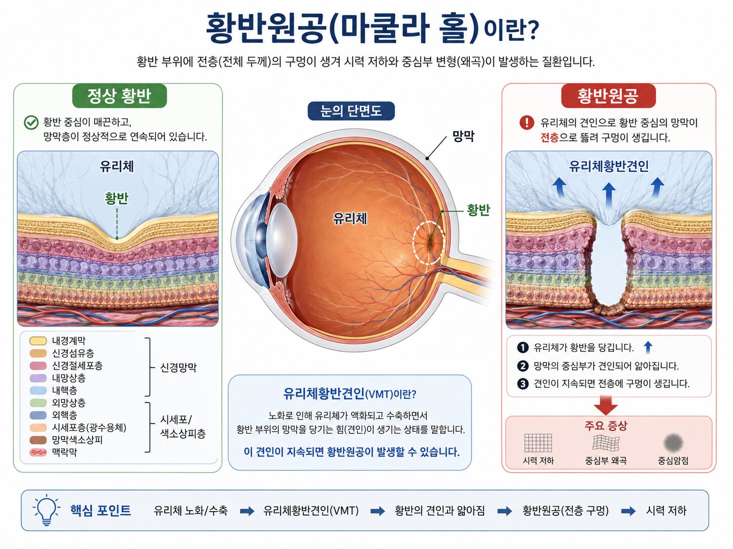 황반원공